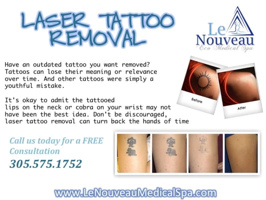 Kat Von D Tattoo Removal